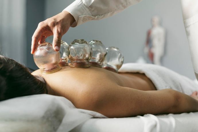 Cupping Therapy for Office Workers: Relieving Back and Shoulder Pain