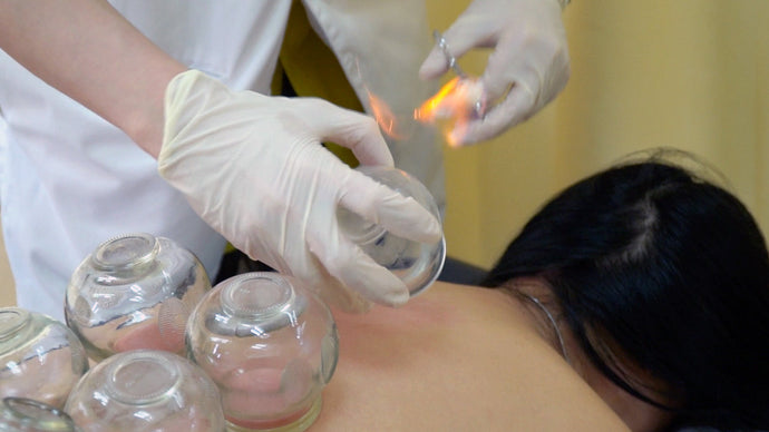 Why Do Some People Get Bruises After Cupping? Understanding TCM Detox Reactions