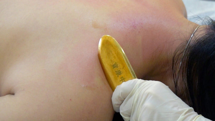 Everything You Need to Know About Guasha in Traditional Chinese Medicine