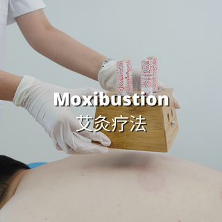 Beacon TCM: Moxibustion